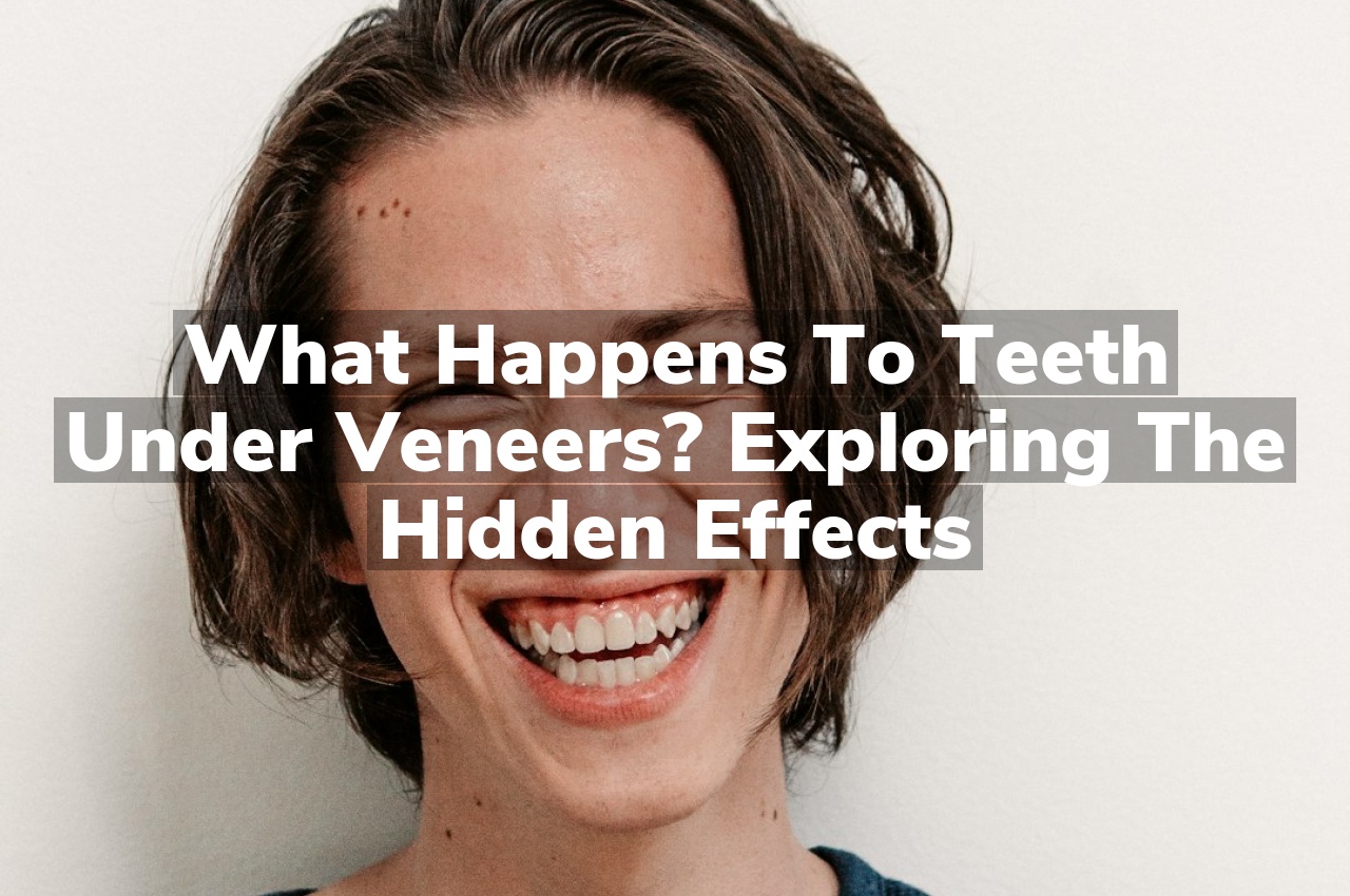 What Happens to Teeth Under Veneers? Exploring the Hidden Effects